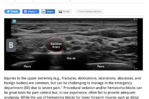 ultrasound article